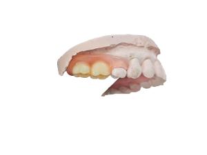 Wholesale Strong and Durable Gardening Simulation Resin for High Aesthetic Orthodontic Treatment from china suppliers