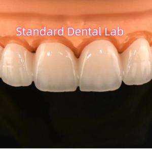 Wholesale Zirconia Crowns Bridge Dental Lab With Layered Porcelain from china suppliers