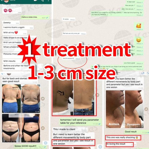 LCD Vela Shape Vacuum Slimming Machine Body And Face Treatment