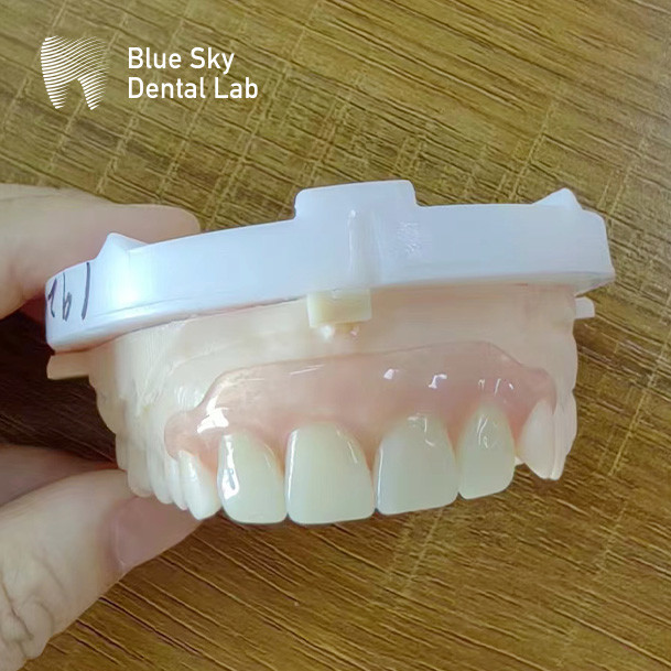 Natural Looking Removable Valplast Partial Dentures For Upper Anterior And Posterior Teeth