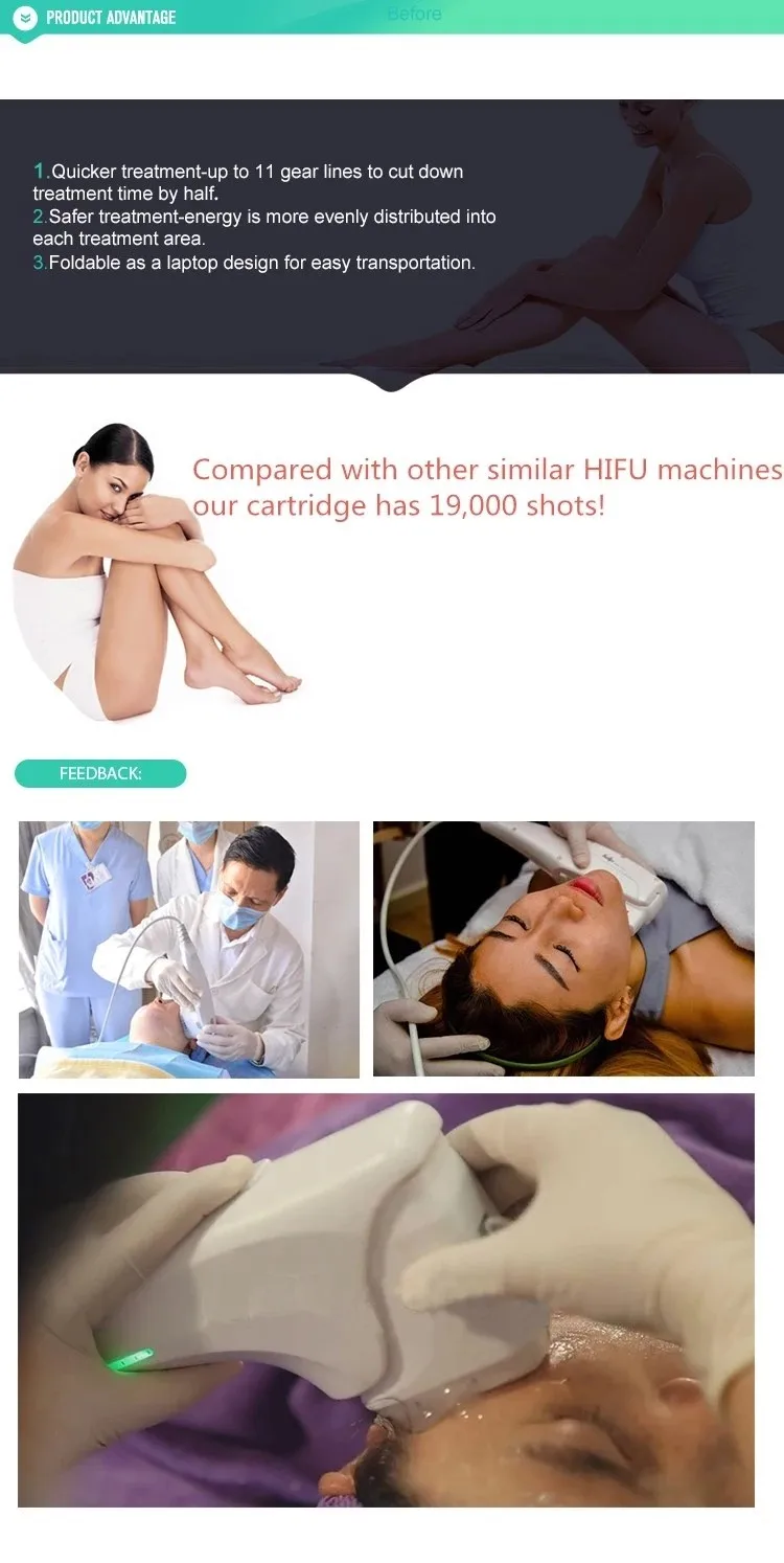 Professional 3D hifu device 11 lines for wrinkle remover