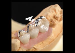 Wholesale Strong PFM Porcelain Fused To Metal Crown Excellent Biocompatibility Wear Resistance from china suppliers