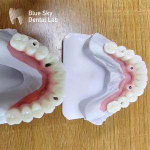 Wholesale Dental Multi Implant Cases Customized Implant Procedure Cases from china suppliers
