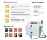Portable Fractional RF Microneedle for Face Lifting
