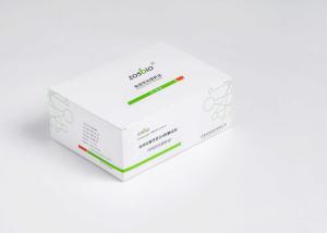 Wholesale 5-200mg/L Serum Amyloid A Rapid Test For Infectious Diseases Pediatrics from china suppliers