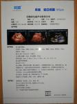 210mm X 297mm 180um Hospital Medical Dry Film Premium White Inkjet X Ray Film