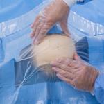Medical Disposable Sterilized Surgical Drape SMS EOS Craniotomy Drape