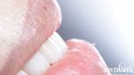 Long Lasting Dental Composite Veneer Good Biocompatibility No Drop Off porcelain