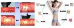 Beauty Salon Women 808nm Diode Laser Hair Removal water Cooling