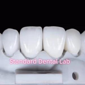 Wholesale Natural Looking Restorations Aidite Dental Zirconia Tooth Crown from china suppliers