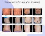Weight Loss Body Slim RF EMS Muscle Stimulator Machine For Fast Slim Body