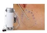 Stationary Surgical Liposuction Machine Power Assisted Surgery Equipment