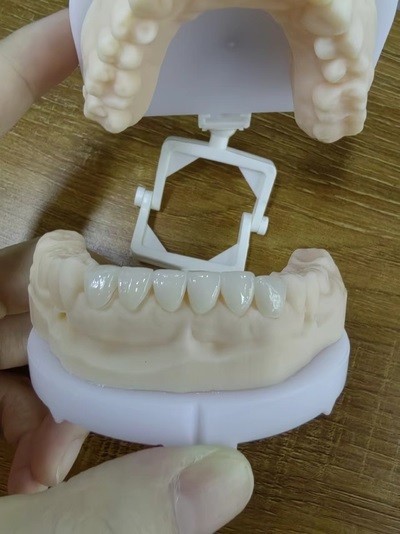 Sleek Premium Veneer Cases 0.3mm Ultra Thin Emax Veneers