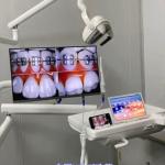 Water Proof Intra Oral Camera Scanner USB 2500mAh For Dental Chair