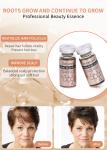 10ml Anti Hair Loss Serum Liquid Set Hair Care Growth Treatment Hair-Loss