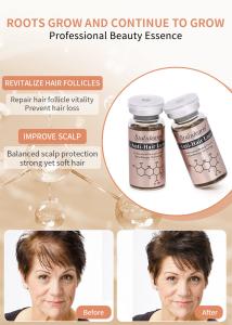 Wholesale Best Quality Anti Hair Loss Care Treatment Scalp Care Prevent Hair Loss Hair Growth Serum from china suppliers