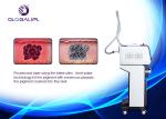 Professional Picosecond ND YAG Laser Machine Carbon Facial Beauty Machine