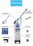 Innovative technology OEM ODM approved 0.12mm-1.25mm adjustable spot size co2