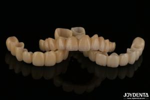 Wholesale Natural Looking Porcelain Layered Zirconia Bridges Wear Resistance High Biocompatibility from china suppliers