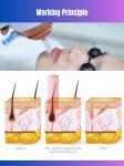 755 808 1064nm OEM Diode Laser Hair Removal Device for Ozero Khanka Pioneer