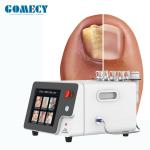 980nm 1470nm Laser Beauty Machine Air Cooling Physical Therapy For Body Pain
