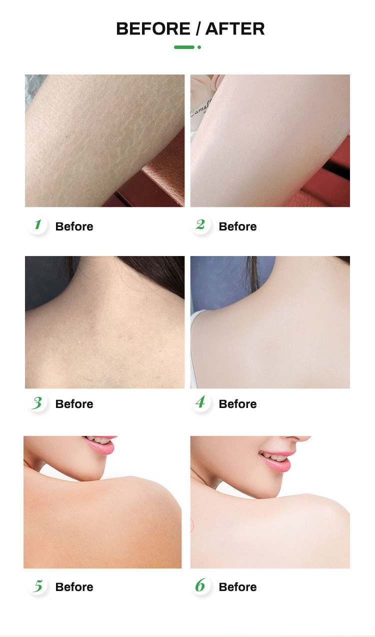 Private Label 200ml Lightening Skin Moisture Body Lotion For Dry Skin