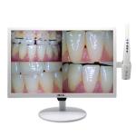 5G Wireless Wifi Dental Intraoral Camera 19 Inch Dental Implant LCD Monitor