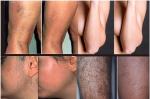 Triple wavelength diode laser machine for hair removal pemanently and painless