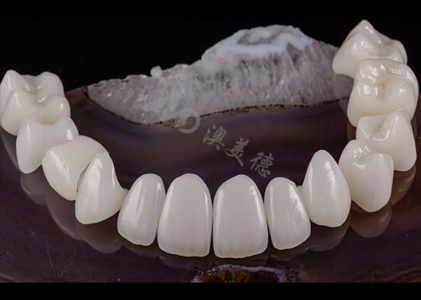 Translucent Dental Tooth Solid Zirconia Crown Natural Aesthetics Chipping