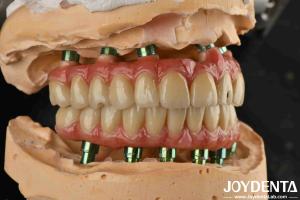 Wholesale Hybrid Technology Titanium Malong Dental Bridge Adjustable For Aesthetic Results from china suppliers