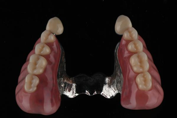 Stain Odor Resistant Full Acrylic Denture Natural Looking Acrylic Resin Denture