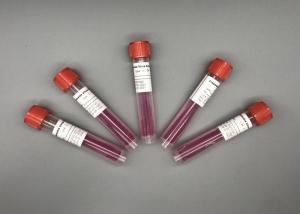 Wholesale ISO13485 Class I Disposal Oral Throat Swab VTM Kit from china suppliers