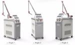 Newest Korea imported laser arm 1064nm 532nm Q Switch Nd: Yag Laser Tattoo