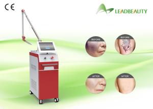 Wholesale Newest 2016 ND Yag laser tattoos removal pigment removal laser from china suppliers
