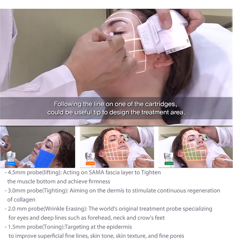 Vertical Ultrasound Hifu Therapy Machine Body 30000 Shots Probe SMAS Transducers For Face Lift