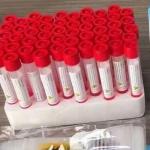 Plastic Injection Mold GF30 Disposable Medical Plastic Parts Mold Syringe