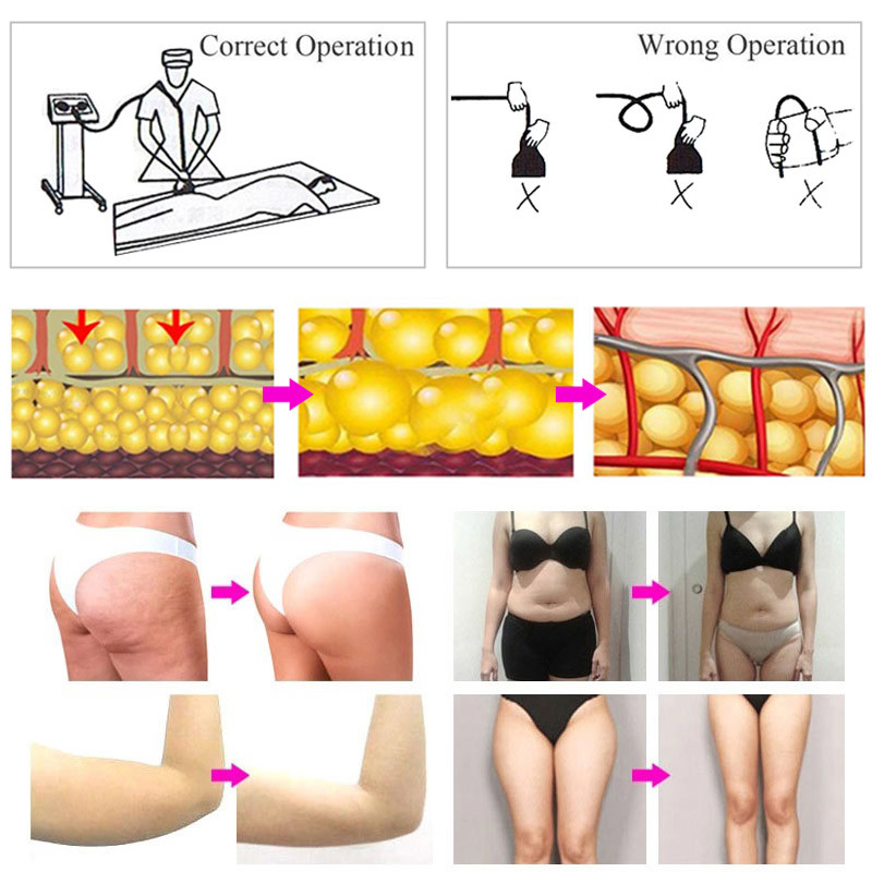 Lymphatic Drainage G5 Cellulite Machine Weight Loss Body Massager Fat Burning