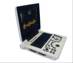 4D Color Ultrasound Portable Ultrasonography Machine Digital