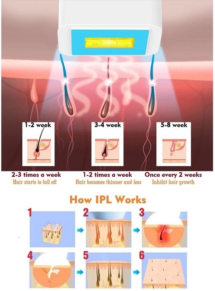 4cm2 Ice Cool IPL Hair Removal