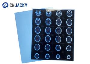 Wholesale Medical Dry Thermal Printer 36m Scanning X Ray Film from china suppliers