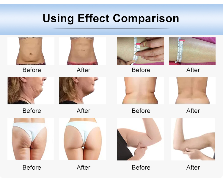 AS84 3D Rf Vacuum Cavitation Machine 6 In 1 Body Slimming Machine With Laser Pads
