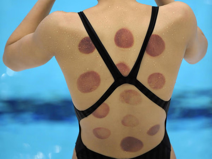 Vacuum Electrode Cupping Therapies Lymph Edema Electric Slimming Russian Wave Ems Muscle Stimulator Machine