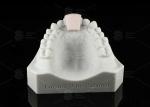Non Removable Lingual Wire Retainer Invisible Direct Bonded Lingual Retainer
