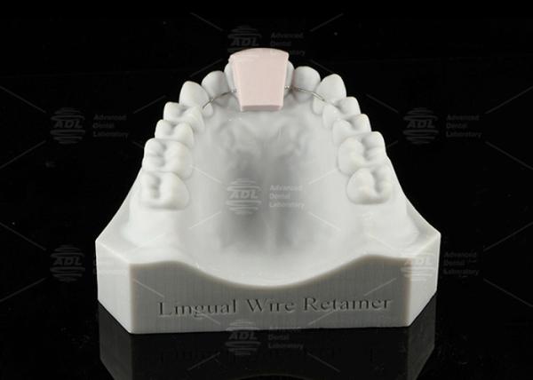 Non Removable Lingual Wire Retainer Invisible Direct Bonded Lingual Retainer