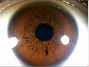 China Green Iris Recognition Camera Iridology Device English Spanish Chinese on sale