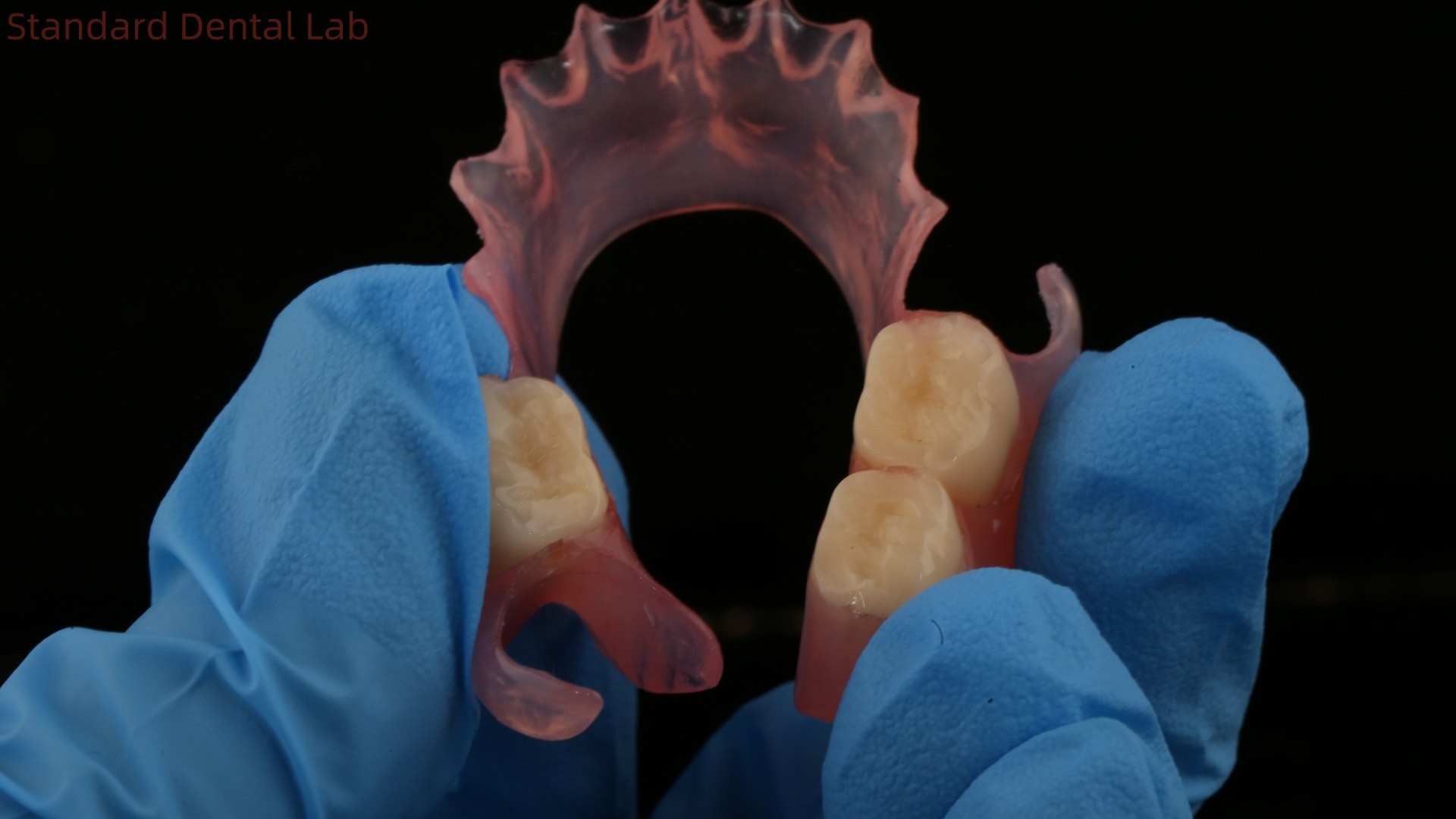 Dental TCS Valplast Flexible Partial Dentures Nesbit Valplast Finish China Dental Lab Valplast Clasp