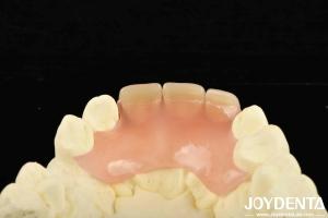 Wholesale Revolutionize Your Dental Practice with Lightweight and Diverse Products from china suppliers