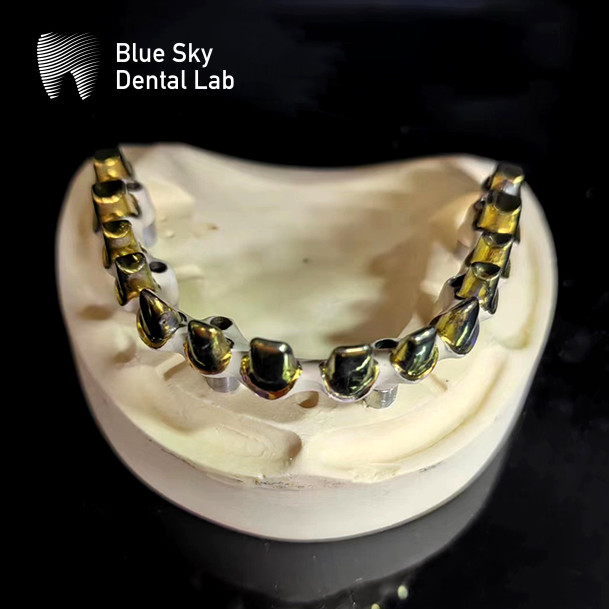 Silver Gold Universal Pure Titanium Metal Frame Dental Customizable