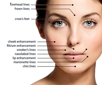 2ml Acido Hialuronico Dermal Lip Fillers Gel For Lip Enhancer , CE / ISO