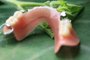 China Partial Removable Acrylic Partial Denture on sale